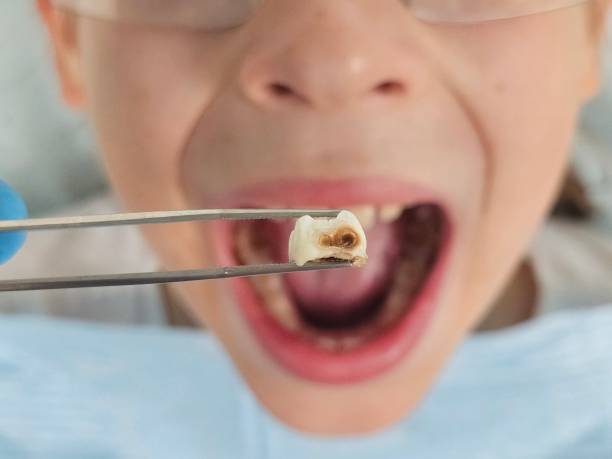 Best Weekend Emergency Dentist in Wye, MT